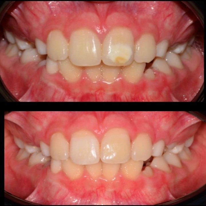Dentisteria Conservadora Minimamente Invasiva